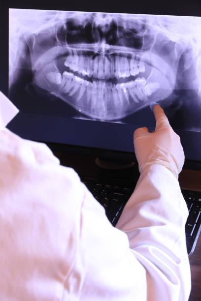 Best Walk-In Emergency Dentist in Maple Glen, PA